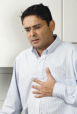 Heartburn after sleeve gastrectomy