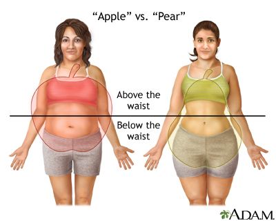 Types of Obesity Types of Obesity